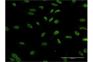 Immunofluorescence of monoclonal antibody to DLX1 on HeLa cell. (DLX1 Antikörper  (AA 152-255))