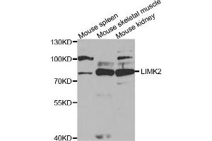 Western Blotting (WB) image for anti-LIM Domain Kinase 2 (LIMK2) antibody (ABIN1876597) (LIMK2 Antikörper)