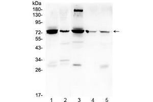 Western blot testing of 1) rat kidney, 2) mouse kidney, 3) human HeLa, 4) (h) 22RV1 and 5) (h) HepG2 lysate with PTGS2 antibody at 0.