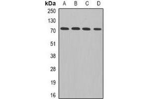 Western blot analysis of ADAM33 expression in Hela (A), MCF7 (B), mouse brain (C), rat heart (D) whole cell lysates. (ADAM33 Antikörper)