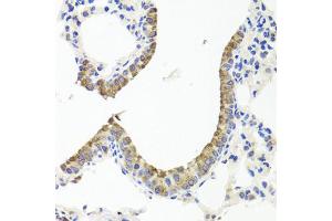 Immunohistochemistry of paraffin-embedded mouse lung using TTR antibody (ABIN5970470) at dilution of 1/100 (40x lens). (TTR Antikörper)