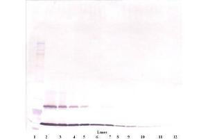 Image no. 3 for anti-Thymic Stromal Lymphopoietin (TSLP) antibody (ABIN465620) (Thymic Stromal Lymphopoietin Antikörper)
