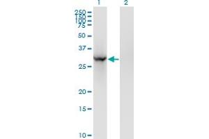 Western Blotting (WB) image for anti-Breast Cancer Metastasis Suppressor 1 (BRMS1) (AA 1-246) antibody (ABIN565191)