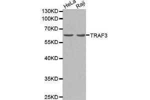 Western blot analysis of extracts of Raji cells lines, using TRAF3 antibody. (TRAF3 Antikörper  (AA 1-100))