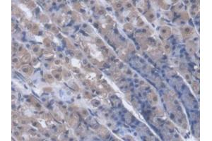 DAB staining on IHC-P; Samples: Rat Stomach Tissue (PNP Antikörper  (AA 1-289))