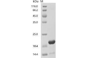 (Tris-Glycine gel) Discontinuous SDS-PAGE (reduced) with 5 % enrichment gel and 15 % separation gel.