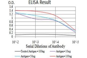 Black line: Control Antigen (100 ng), Purple line: Antigen(10 ng), Blue line: Antigen (50 ng), Red line: Antigen (100 ng), (Estrogen Receptor alpha Antikörper  (pTyr537))