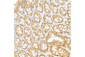 Immunohistochemistry (Paraffin-embedded Sections) (IHC (p)) image for anti-LI Cadherin antibody (ABIN7074493)