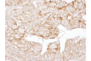 Immunohistochemistry (IHC) image for anti-Adducin 1 (Alpha) (ADD1) (AA 550-600) antibody (ABIN7453420) (alpha Adducin Antikörper  (AA 550-600))
