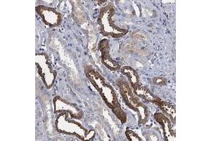 Immunohistochemical staining of human kidney with TMEM72 polyclonal antibody  shows strong cytoplasmic positivity in tubular cells at 1:200-1:500 dilution. (TMEM72 Antikörper)