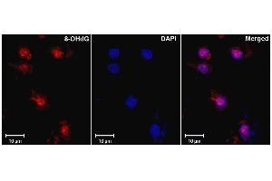 Immunohistochemistry analysis using Mouse Anti-DNA Damage Monoclonal Antibody, Clone 15A3 . (DNA/RNA Damage Antikörper (FITC))