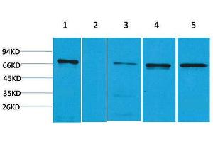 Western Blotting (WB) image for anti-Zinc Finger and BTB Domain Containing 45 (ZBTB45) antibody (ABIN3179016) (ZBTB45 Antikörper)
