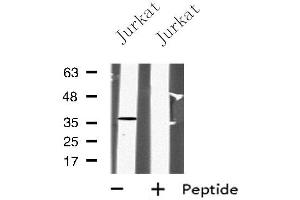 Western blot analysis of PPP2CA using Jurkat whole cell lysates (PPP2CA Antikörper  (C-Term))