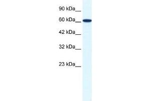 ZNF266 antibody used at 1. (ZNF266 Antikörper  (N-Term))