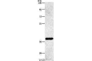 Western blot analysis of Human fetal liver tissue, using PRKAG1 Polyclonal Antibody at dilution of 1:500 (PRKAG1 Antikörper)
