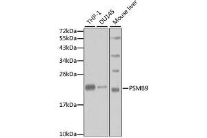 Western blot analysis of extracts of various cell lines, using PSMB9 antibody. (PSMB9 Antikörper)