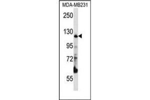 Western blot analysis of PITRM1 Antibody (Center) in MDA-MB231 cell line lysates (35ug/lane). (PITRM1 Antikörper  (Middle Region))