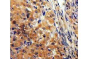 IHC-P analysis of Ovary tissue, with DAB staining. (KNG1 Antikörper  (AA 390-644))
