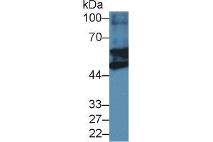 Detection of GFAP in Mouse Heart lysate using Polyclonal Antibody to Glial Fibrillary Acidic Protein (GFAP) (GFAP Antikörper  (AA 253-354))