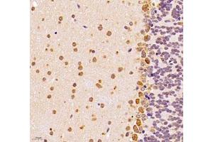 Immunohistochemistry of paraffin embedded mouse epencephalon using UQCC (ABIN7076094) at dilution of 1: 1000 (400x lens) (Ubiquinol-Cytochrome C Reductase Complex Chaperone (UQCC) Antikörper)