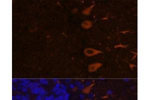 Immunofluorescence analysis of Rat brain using KAL1 Polyclonal Antibody at dilution of 1:100. (KAL1 Antikörper)