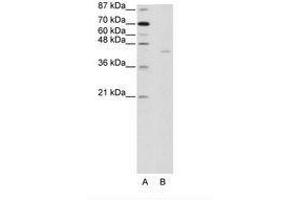 Image no. 1 for anti-PiggyBac Transposable Element Derived 1 (PGBD1) (AA 721-770) antibody (ABIN202922) (PGBD1 Antikörper  (AA 721-770))