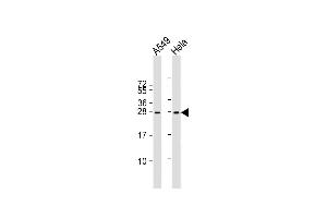 All lanes : Anti-IGF2 Antibody (Center R54) at 1:2000 dilution Lane 1: A549 whole cell lysate Lane 2: Hela whole cell lysate Lysates/proteins at 20 μg per lane. (IGF2 Antikörper  (AA 39-68))