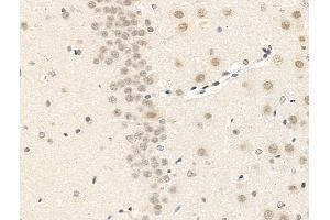 ABIN7094823 and ABIN7098874 at 1/100 staining Rat brain tissue by IHC-P. (MAML2 Antikörper  (C-Term))