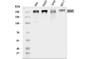 Western blot analysis of CDK5RAP2 using anti-CDK5RAP2 antibody (ABIN7600238). (CDK5RAP2 Antikörper  (AA 168-1878))