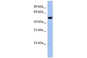 MAP2K7 antibody used at 1 ug/ml to detect target protein. (MAP2K7 Antikörper  (Middle Region))
