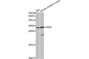 Western blot analysis of extracts of various cell lines, using SSX5 antibody. (SSX5 Antikörper)