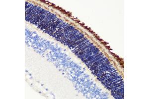 Immunohistochemistry of paraffin-embedded mouse retina using PDE6B antibody (ABIN6132473, ABIN6145363, ABIN6145364 and ABIN6222688) at dilution of 1:200 (40x lens). (PDE6B Antikörper  (AA 1-190))