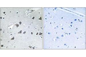 Immunohistochemistry analysis of paraffin-embedded human brain tissue, using EIF3F Antibody. (EIF3F Antikörper  (AA 81-130))