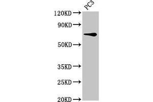 Western Blot Positive WB detected in: PC-3 whole cell lysate All lanes: SCNN1B antibody at 8 μg/mL Secondary Goat polyclonal to rabbit IgG at 1/50000 dilution Predicted band size: 73, 78 kDa Observed band size: 73 kDa (SCNN1B Antikörper  (AA 554-640))