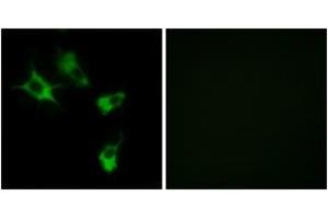Immunofluorescence analysis of COS7 cells, using MAST4 Antibody. (MAST4 Antikörper  (AA 251-300))