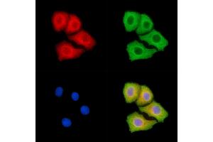 ABIN7094909 and ABIN7098963 staining Hela cells by IF/ICC. (IL23 Antikörper)
