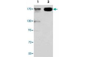 Western blot analysis of JARID1C monoclonal antibody  at 1:1000 dilution. (KDM5C Antikörper  (C-Term))