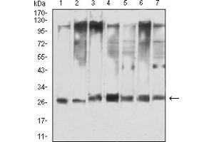 Western blot analysis using YWHAQ mouse mAb against Hela (1), NIH/3T3 (2), C6 (3), A549 (4), COS7 (5), PC-12 (6), and HEK293 (7) cell lysate. (14-3-3 theta Antikörper  (AA 1-245))