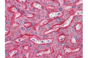 Human Liver: Formalin-Fixed, Paraffin-Embedded (FFPE) (SQSTM1 Antikörper  (C-Term))