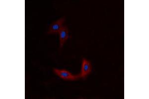 Immunofluorescent analysis of BMX staining in A549 cells.