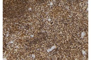ABIN6272986 at 1/100 staining Mouse spleen tissue by IHC-P.