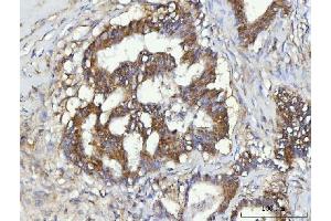 IHC analysis of CBR1 using anti-CBR1 antibody (ABIN7600015). (CBR1 Antikörper  (AA 14-262))