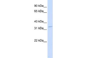 WB Suggested Anti-OTX2 Antibody Titration:  0. (OTX2 Antikörper  (Middle Region))