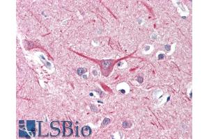 ABIN570789 (5µg/ml) staining of paraffin embedded Human Cortex. (UBR2 Antikörper  (Internal Region))