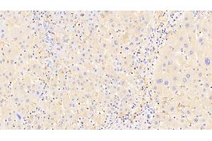 Detection of a2M in Human Liver Tissue using Polyclonal Antibody to Alpha-2-Macroglobulin (a2M) (alpha 2 Macroglobulin Antikörper  (AA 616-856))
