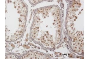 Immunoperoxidase of monoclonal antibody to PIM1 on formalin-fixed paraffin-embedded human testis. (PIM1 Antikörper  (AA 1-100))
