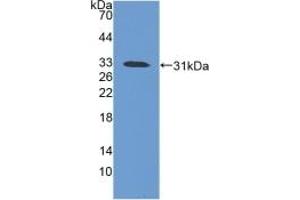 Detection of Recombinant iNV, Mouse using Polyclonal Antibody to Involucrin (INV) (Involucrin Antikörper  (AA 301-460))