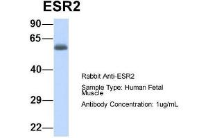 Host:  Rabbit  Target Name:  ESR2  Sample Type:  Human Fetal Muscle  Antibody Dilution:  1. (ESR2 Antikörper  (N-Term))