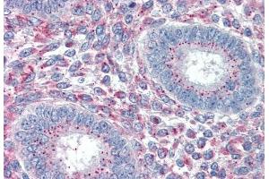Immunohistochemistry (IHC) image for anti-Paired Related Homeobox 1 (PRRX1) (Internal Region) antibody (ABIN238608)