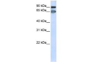 WB Suggested Anti-MED16 Antibody Titration: 0. (MED16 Antikörper  (C-Term))